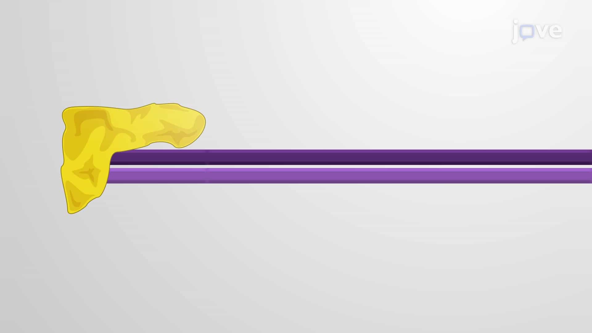 siRNA - Small Interfering RNAs: Post-transcription Gene Silencing
