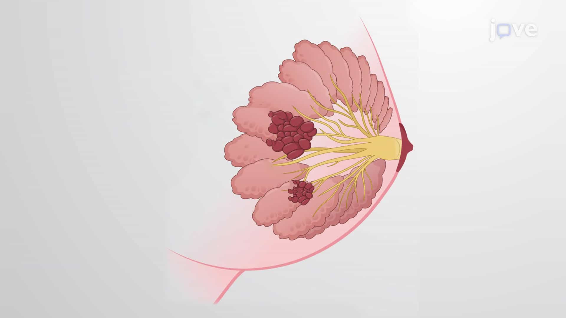 Cancer Therapies: Radiotherapy, Chemotherapy, Immunotherapy and Hormone Therapy