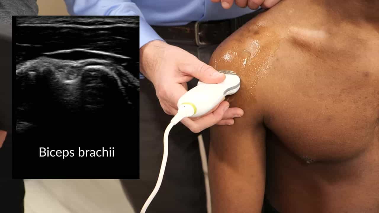 Using Point of Care Ultrasound to Augment Acquisition of Physical Exam Skills: Knee and Shoulder