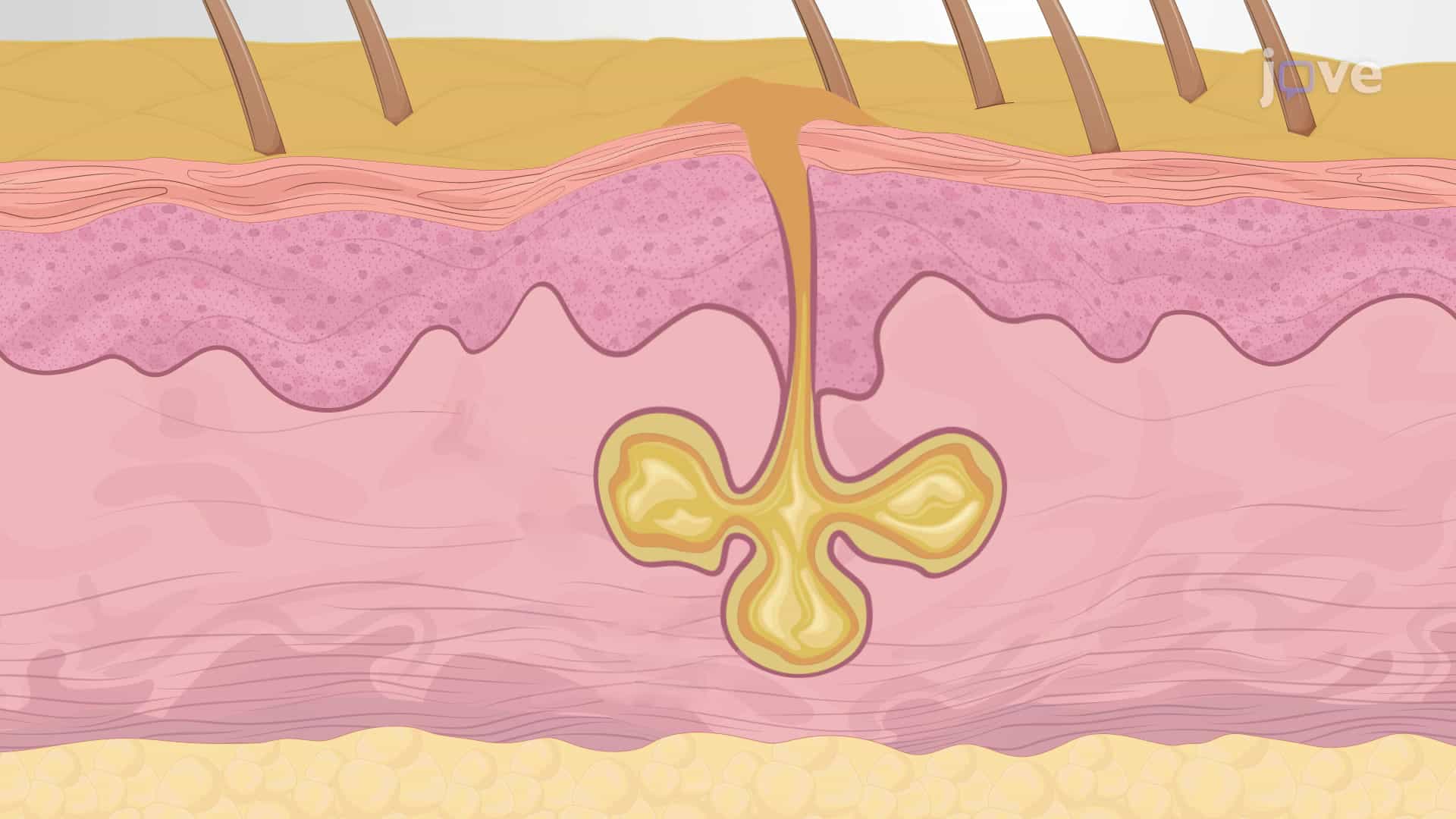 Accessory Structures of the Skin: Sebaceous Glands