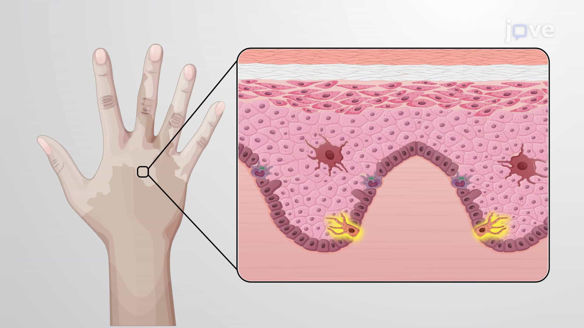Skin Diseases and Disorders