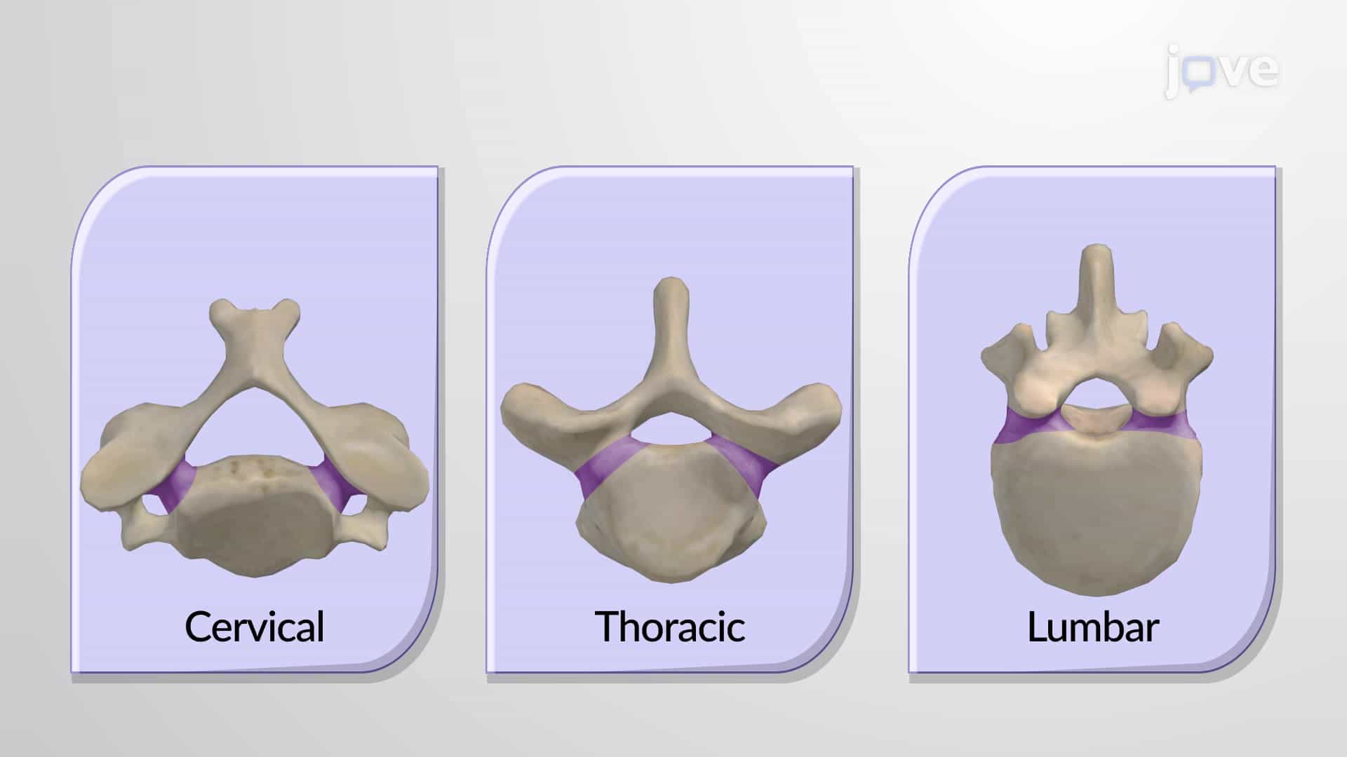 General Structure of a Vertebra