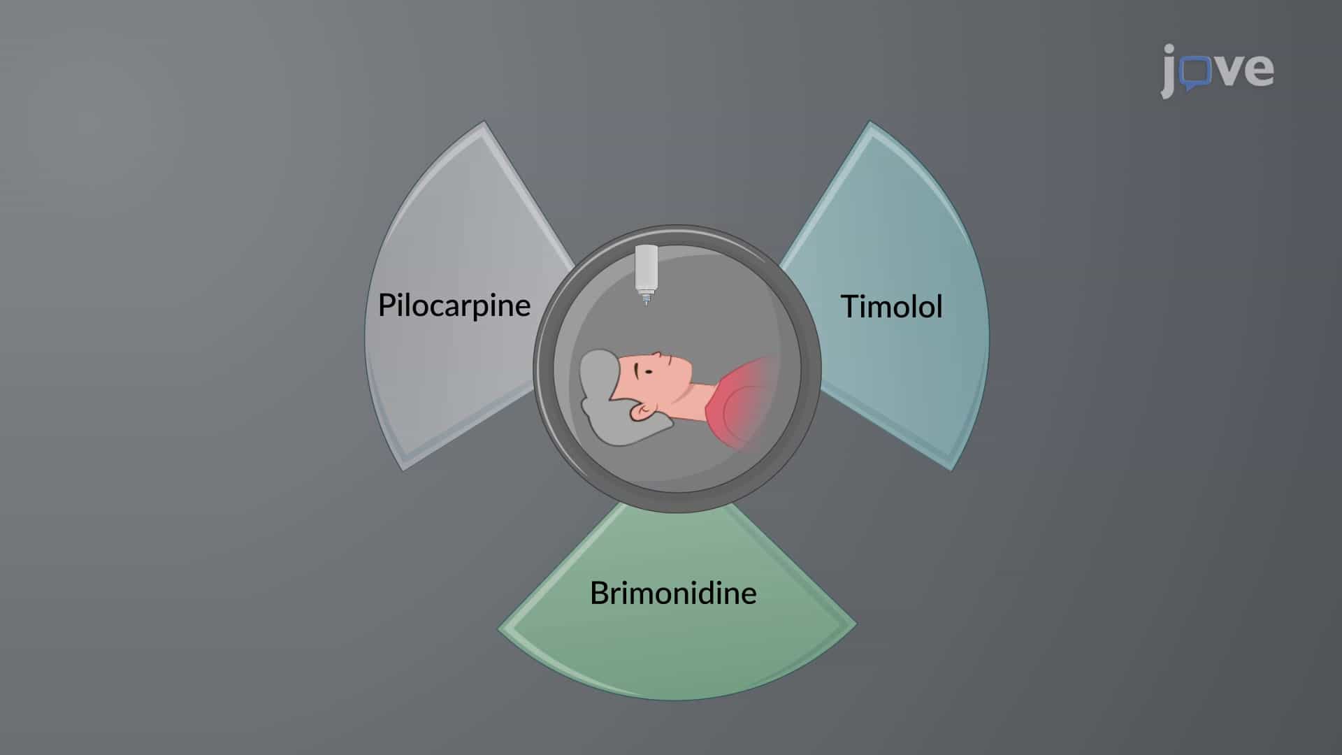 Open Angle Glaucoma: Treatment