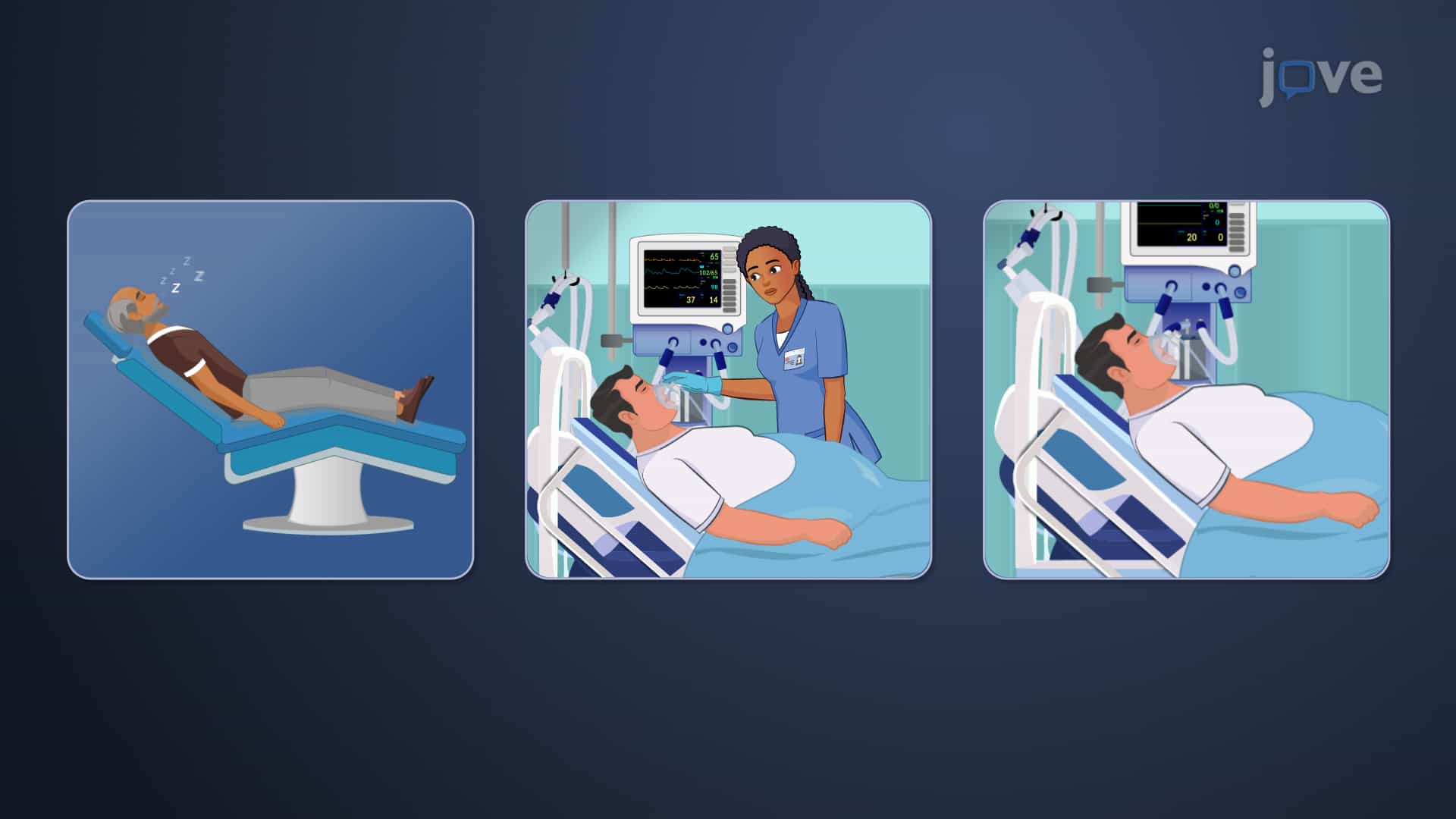 Sedatives and Hypnotics Drugs: Benzodiazepines