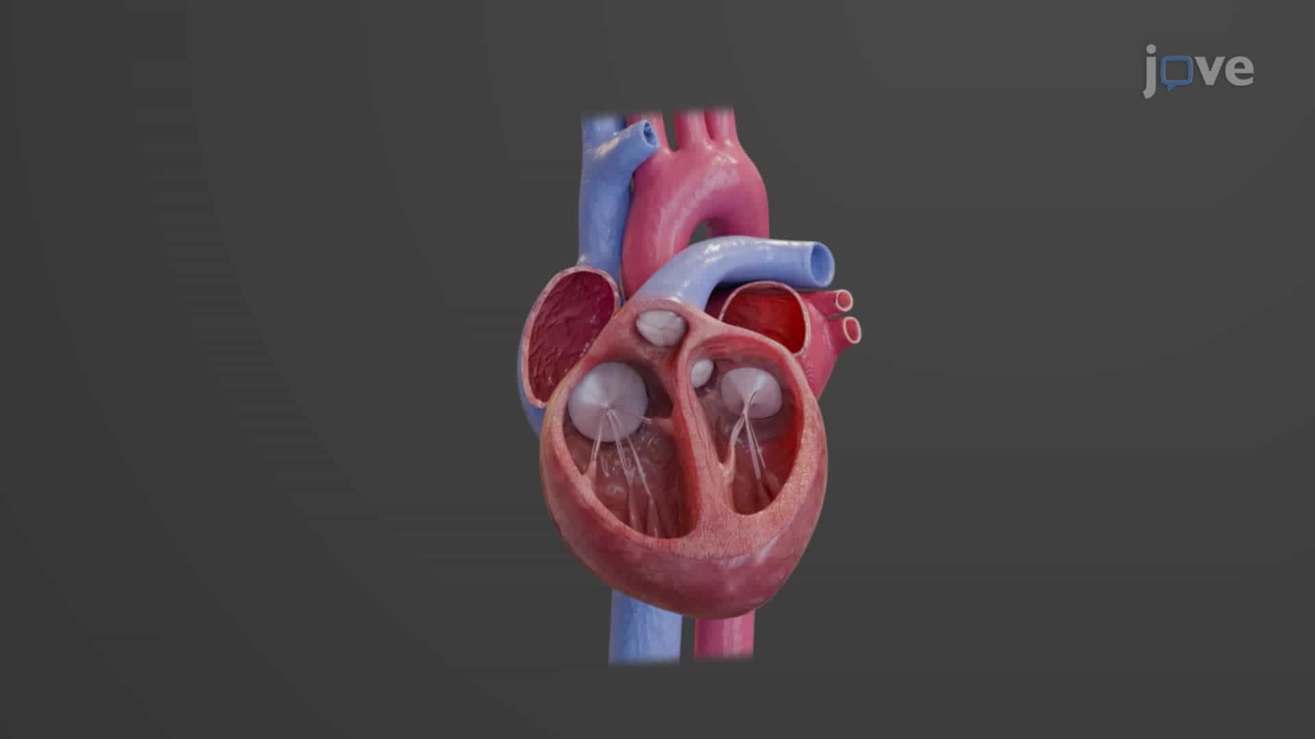 Chambers of the Heart