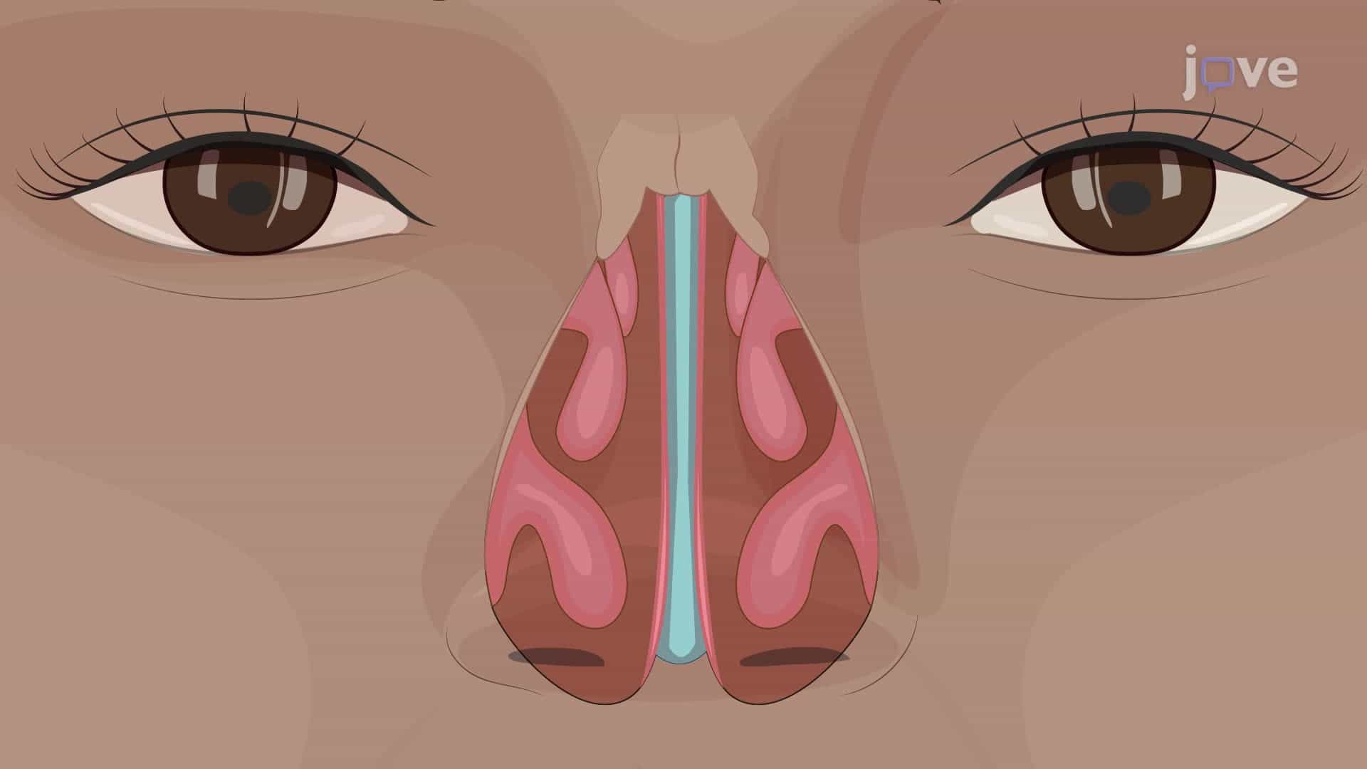Nose and Nasal Cavity