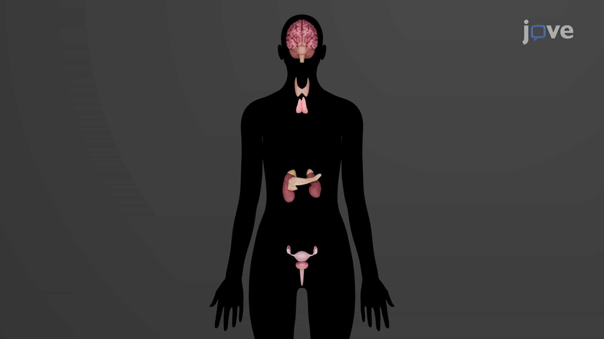Autoimmune Disorders