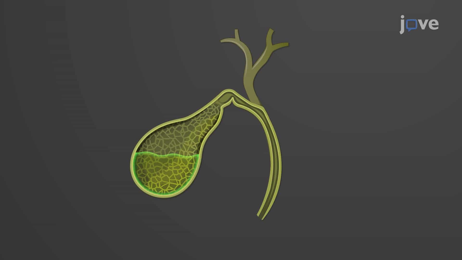Gallbladder