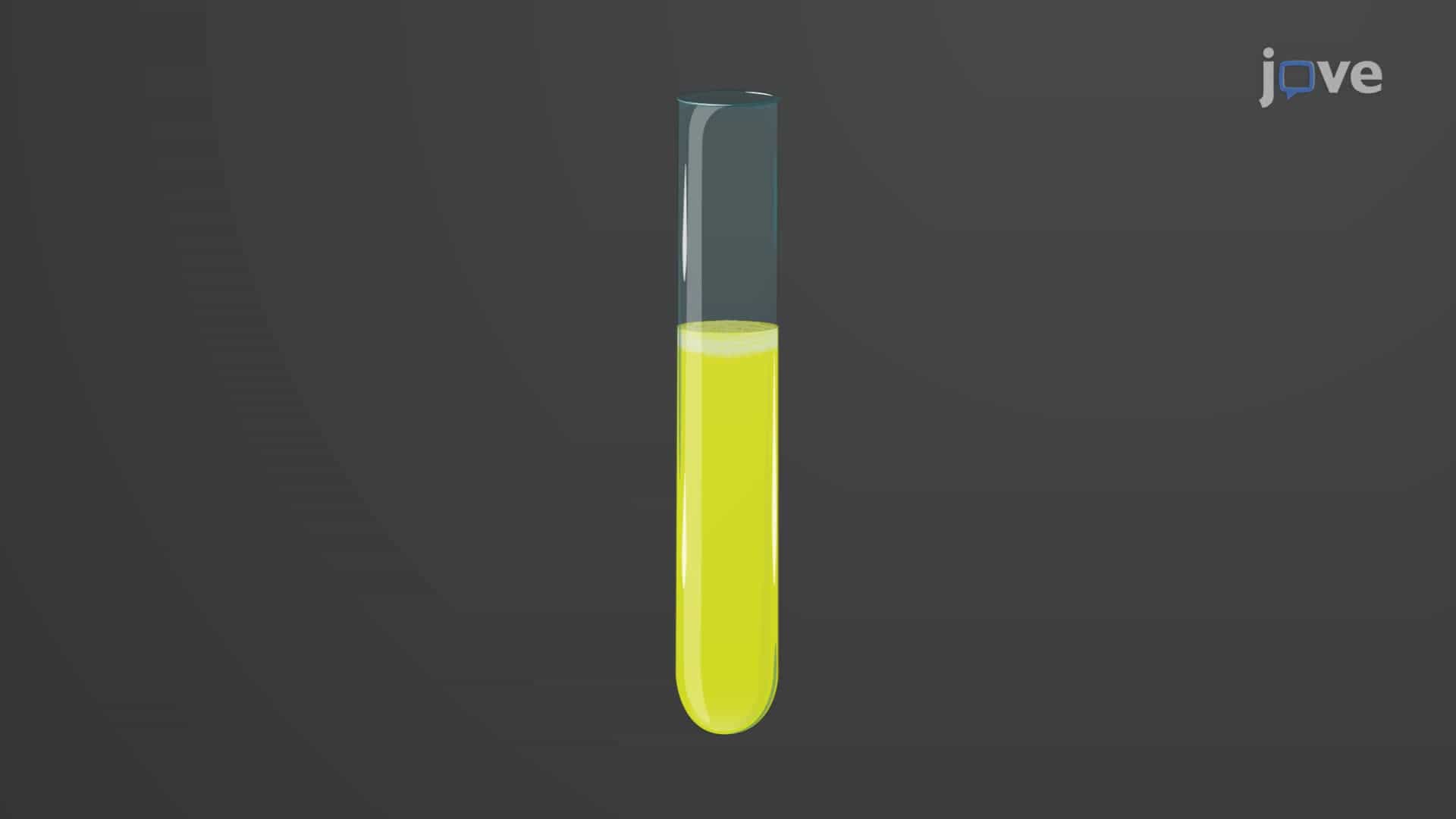Urine: Physical and Chemical Properties