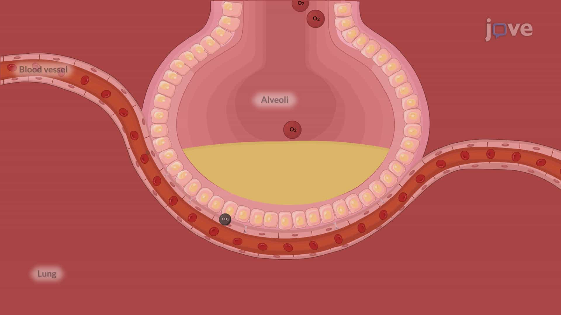 Acute Respiratory Failure-I