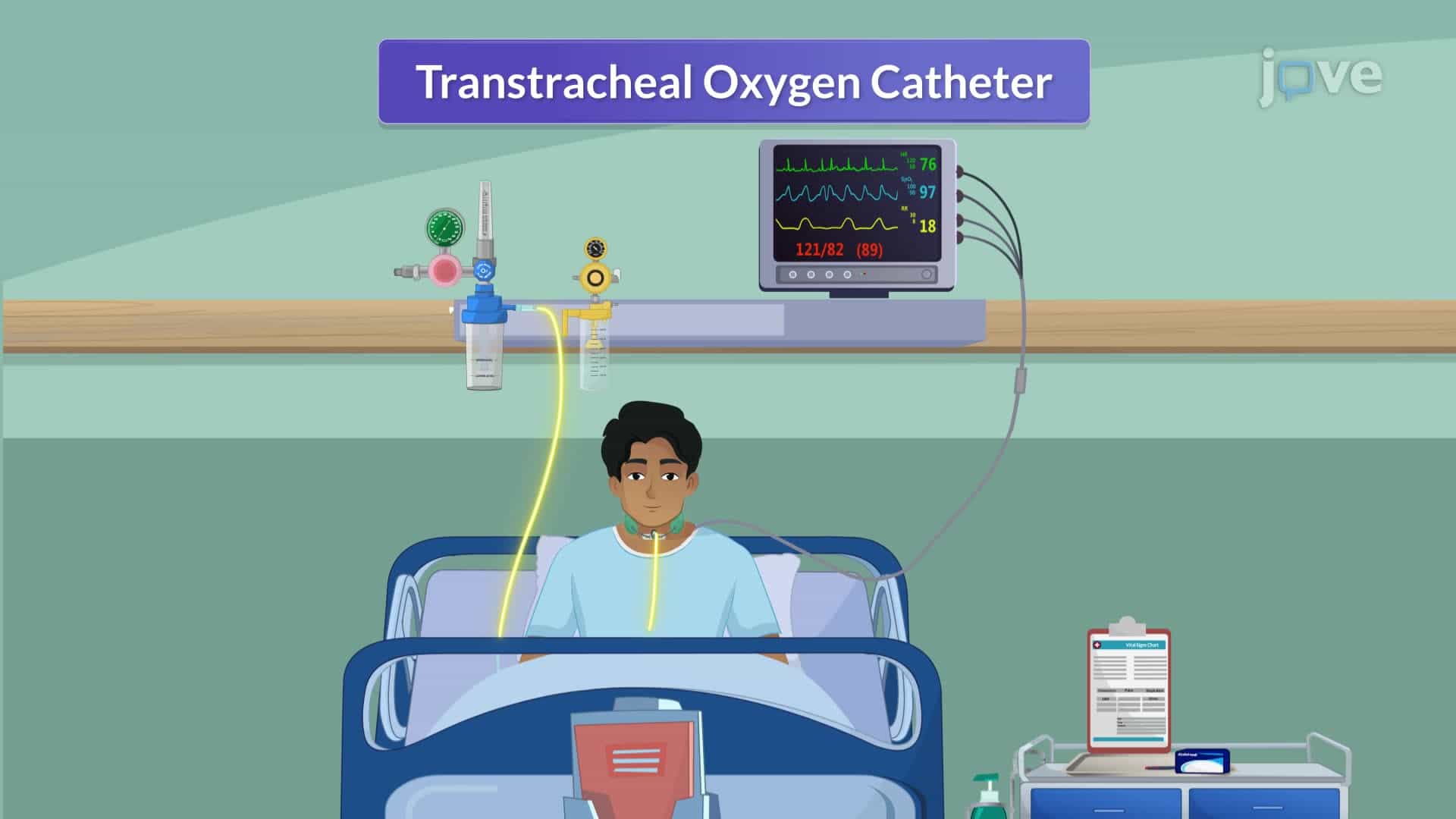 Oxygen Delivering System II: Venturi Mask and Transtracheal Oxygen