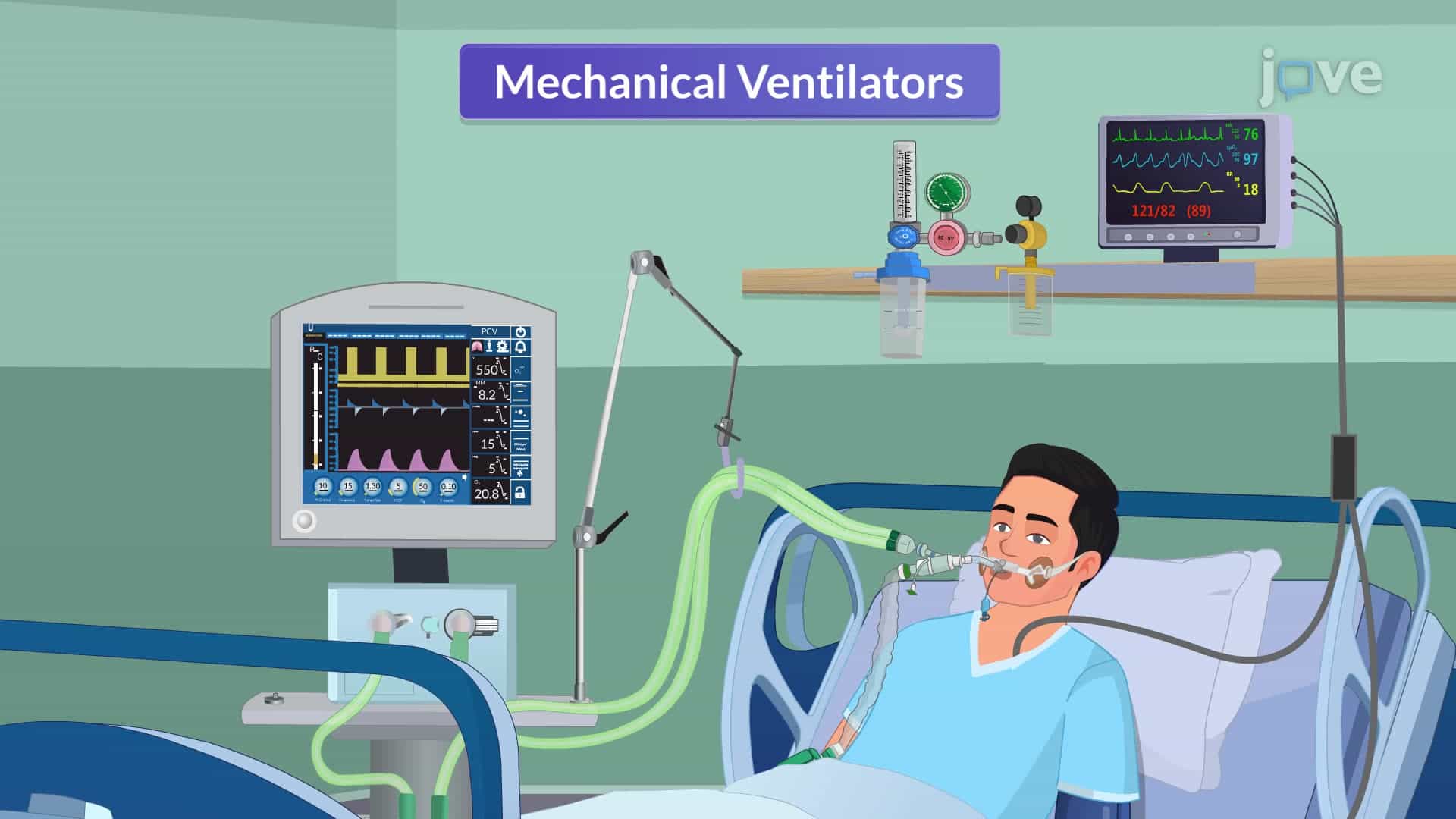Ventilatory Modes