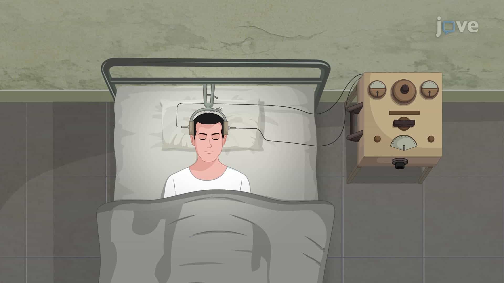 Electroconvulsive Therapy