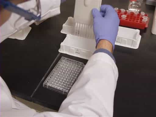 ELISA Method: Detection of Target Protein Using Antibodies