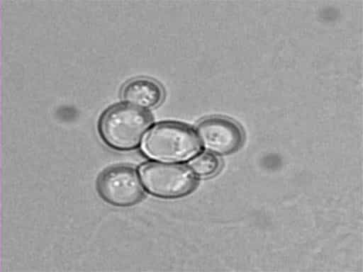 Saccharomyces cerevisiae Yeast as a Model Organism