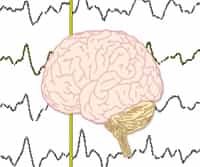 Introduction to Neurophysiology: Methods &amp; Applications