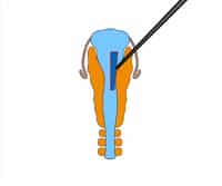 Transplantation Studies: Techniques and Applications