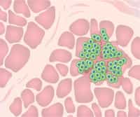 Somatic Stem cells in Tissue Repair and Regeneration
