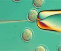 Genome Editing: ZFNs, TALENs, and CRISPR-cas9 System