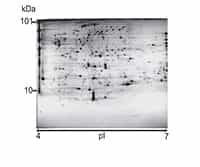 Two-Dimensional Gel Electrophoresis
