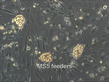 ES Cell-derived Neuroepithelial Cell Cultures