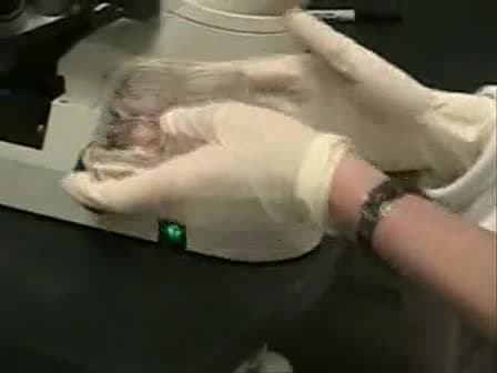 Propagation of Human Embryonic Stem ES Cells