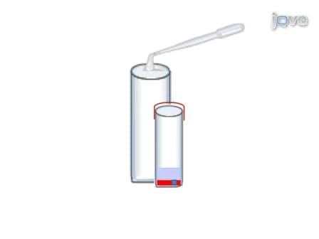Cell Block Preparation from Cytology Specimen with Predominance of Individually Scattered Cells