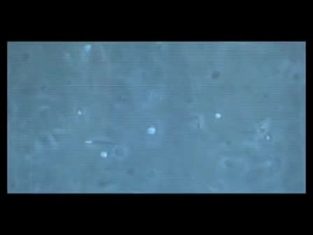 Fluorescence in situ hybridization (FISH) Protocol in Human Sperm