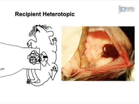 Heterotopic and Orthotopic Tracheal Transplantation in Mice used as Models to Study the Development of Obliterative Airway Disease