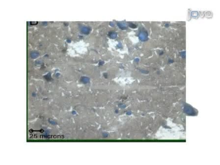 Obtaining High Quality RNA from Single Cell Populations in Human Postmortem Brain Tissue