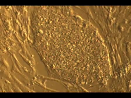 Chromosomal Spread Preparation of Human Embryonic Stem Cells for Karyotyping