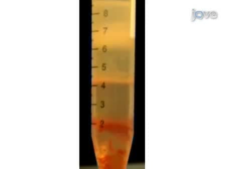 Neutrophil Extracellular Traps: How to Generate and Visualize Them