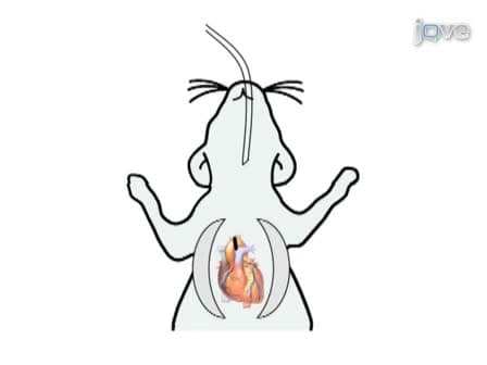 Transverse Aortic Constriction in Mice