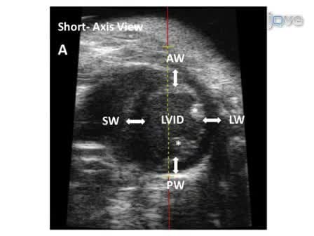 Transthoracic Echocardiography in Mice