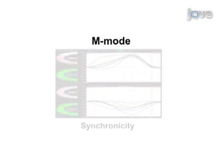High-frequency High-resolution Echocardiography: First Evidence on Non-invasive Repeated Measure of Myocardial Strain, Contractility, and Mitral Regurgitation in the Ischemia-reperfused Murine Heart
