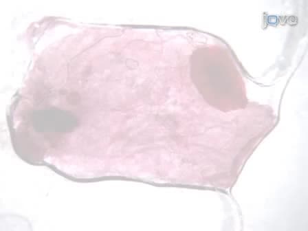 Mammary Epithelial Transplant Procedure