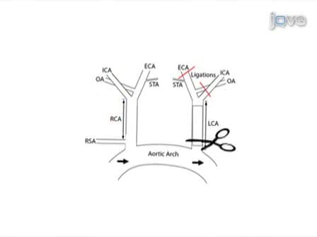 A Model of Disturbed Flow-Induced Atherosclerosis in Mouse Carotid Artery by Partial Ligation and a Simple Method of RNA Isolation from Carotid Endothelium