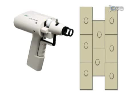 Bimolecular Fluorescence Complementation BiFC Assay for Protein-Protein Interaction in Onion Cells Using the Helios Gene Gun
