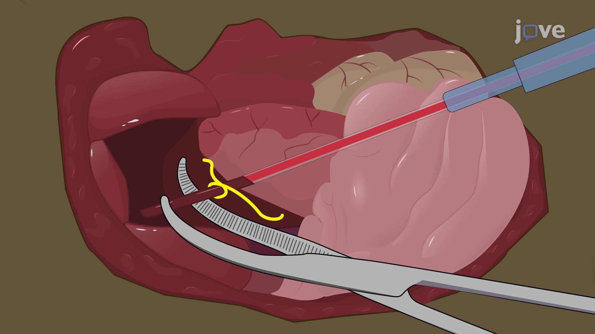 In Vivo Murine Liver Perfusion: A Method to Infuse the Rodent Liver with Solution via the Portal Vein