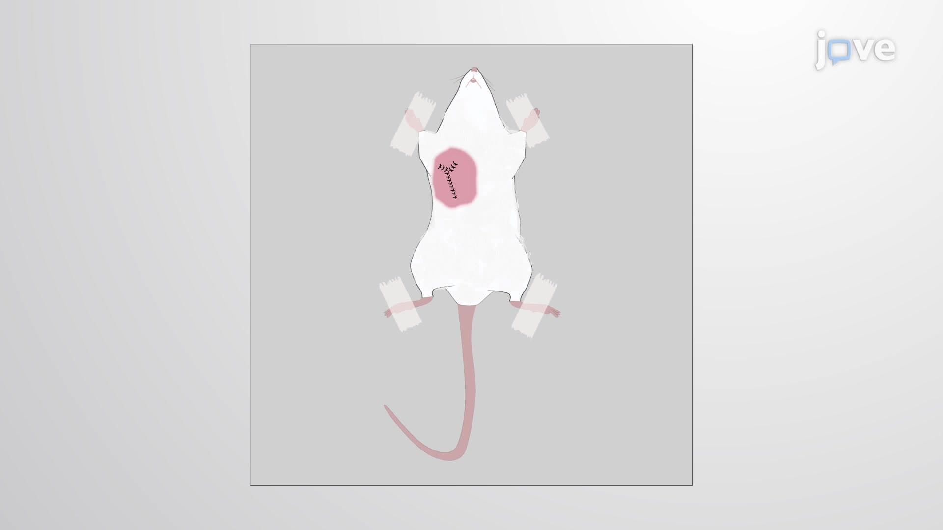 Radical Mastectomy: Surgical Removal of the Entire Mammary Gland from a Mouse to Study Cancer Progression