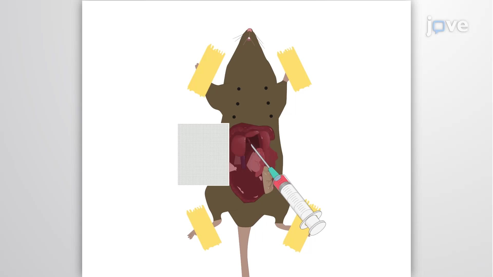 Portal Vein Injection: A Method to Study Cancer Metastasis to the Liver
