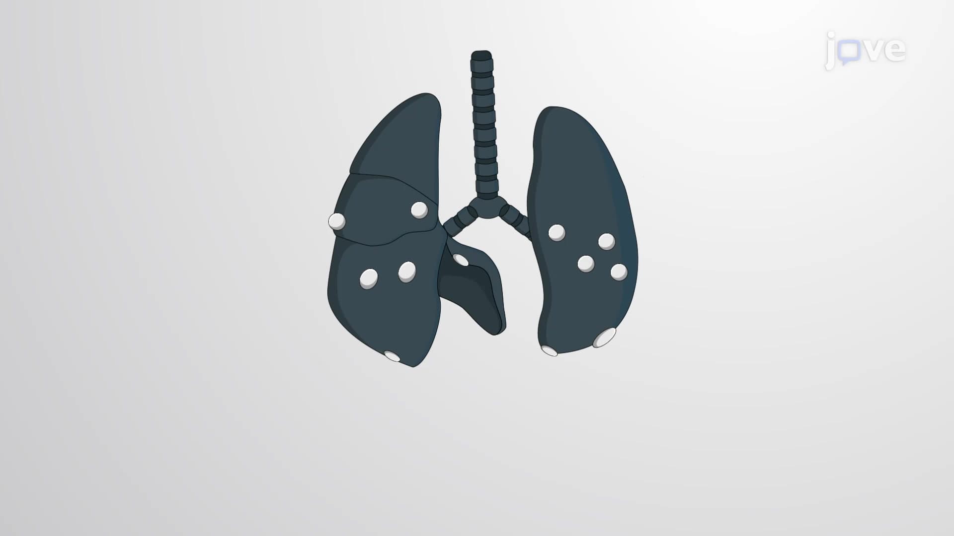 India Ink Inflation: A Staining Method to Visualize Tumor Nodules