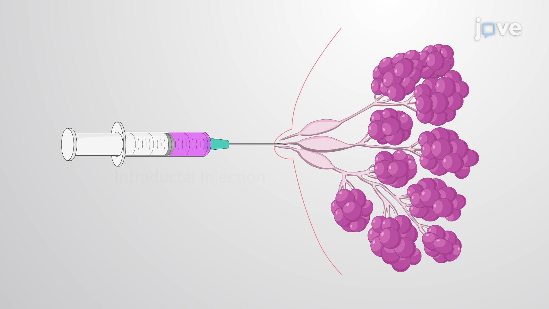 Rabbit Intraductal Injection: Localized Delivery of Solution of Interest into the Rabbit Mammary Gland