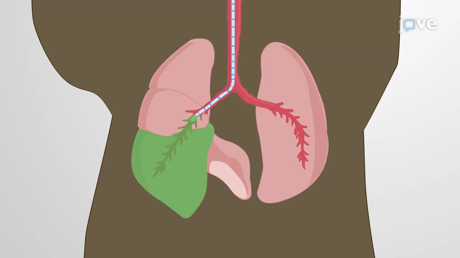 Intrabronchial Delivery: A Technique to Administer an Experimental Agent Selectively Into a Mouse Lung