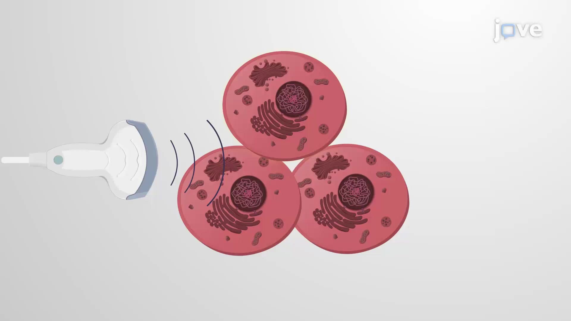 Low Frequency Ultrasound Application: A Method to Determine the Effect of Sonication on Human Leukemia Cells
