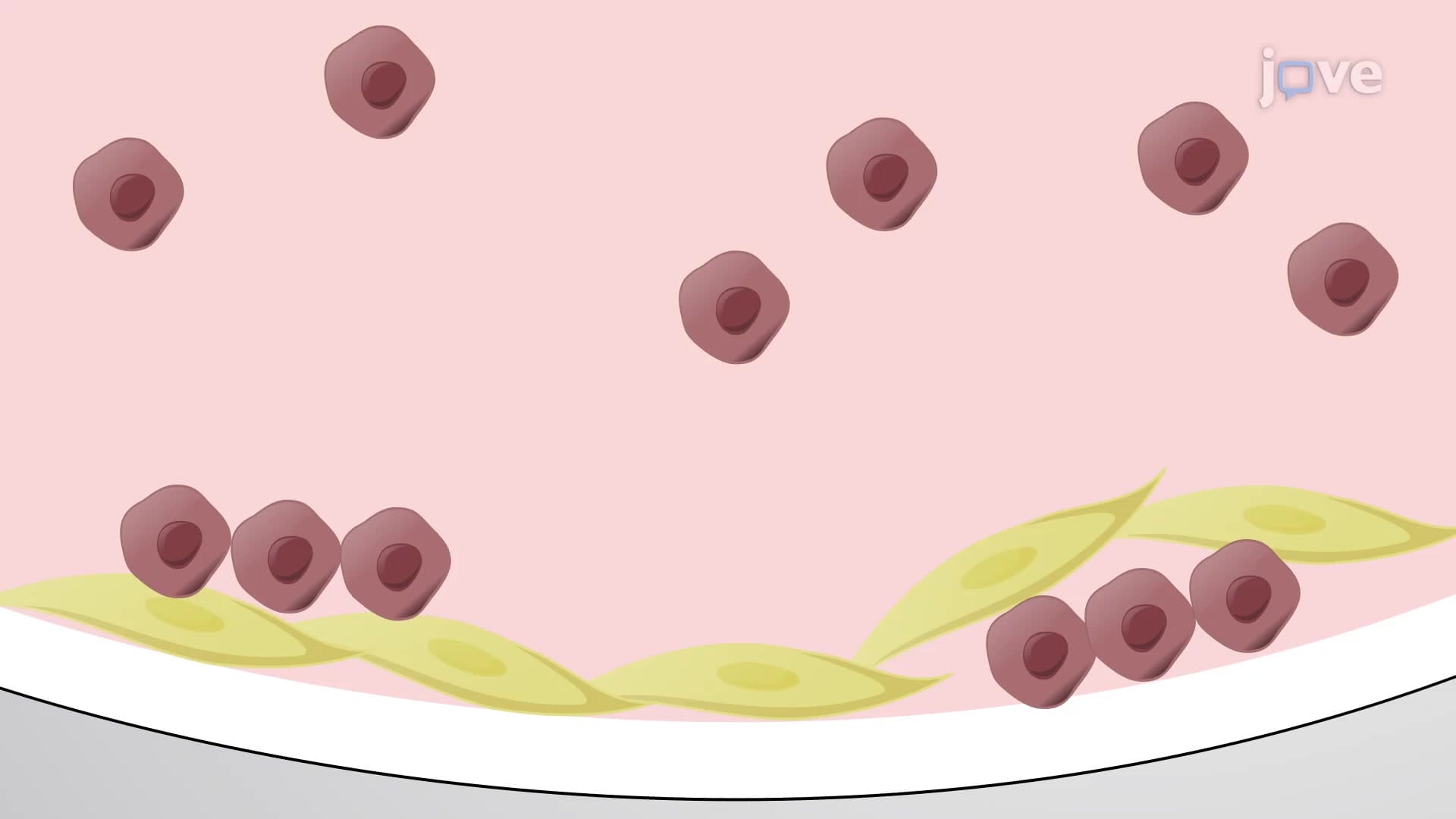 Leukemic Subpopulation Harvest: A Method for Spatial Separation of Leukemic Cell Subpopulations from 2D Co-culture