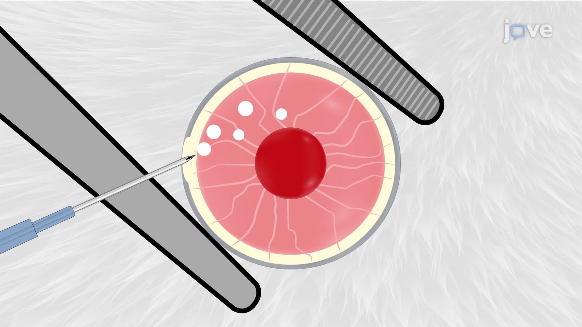 Grafting Pancreatic Islets: A Method to Implant Pancreatic Islets into the Anterior Chamber of the Mouse Eye for In Vivo Imaging