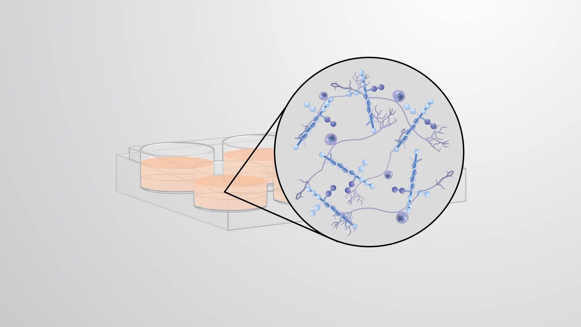 In Vitro Pancreatic Neuroplasticity Assay: Studying Changes in GI Tract Neurons Exposed to Healthy and Cancerous Human Pancreatic Tissue Extracts