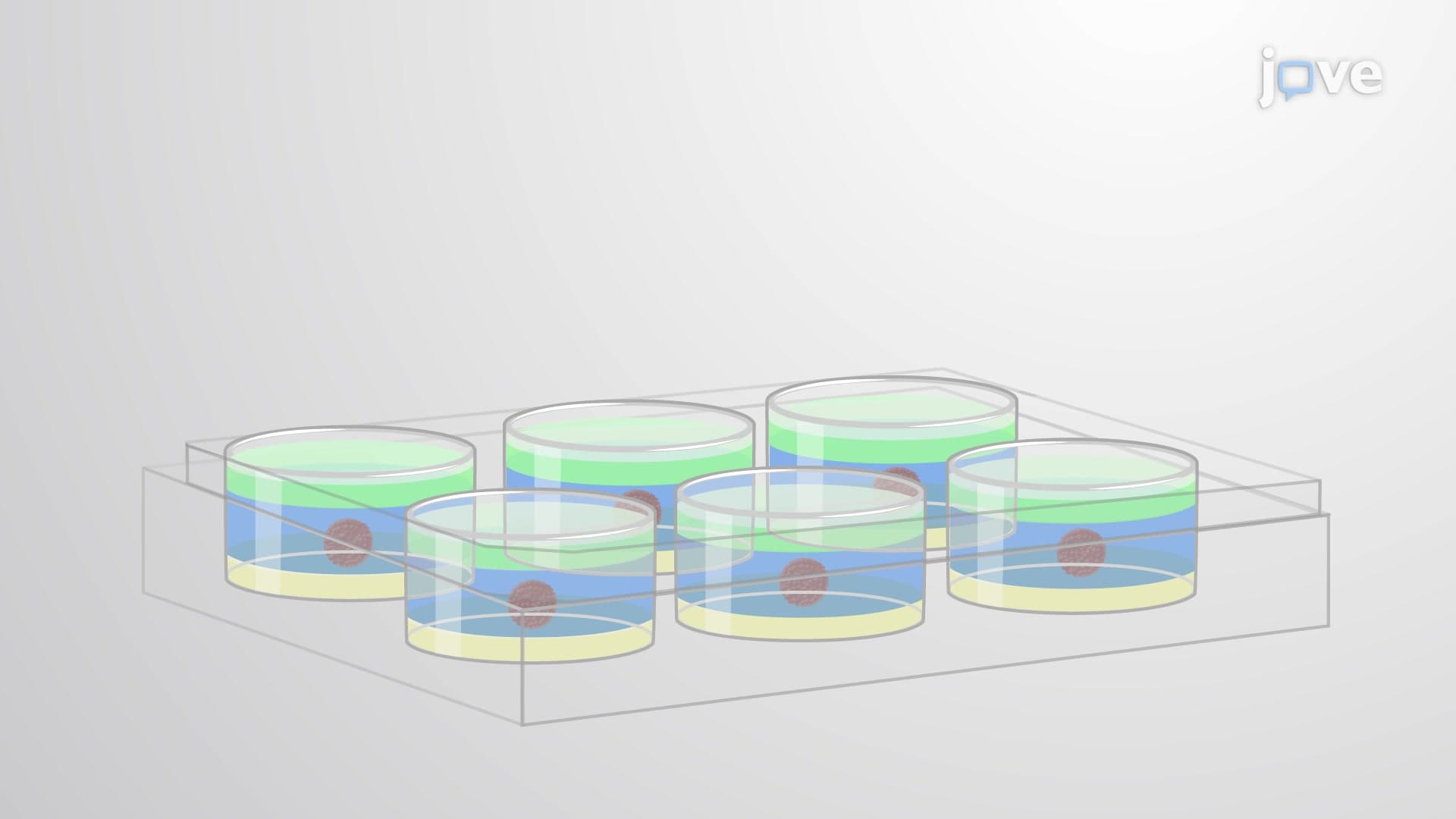 CRC Organoid Culture: A Method to Obtain 3D Organoids from Colorectal Cancer Cells