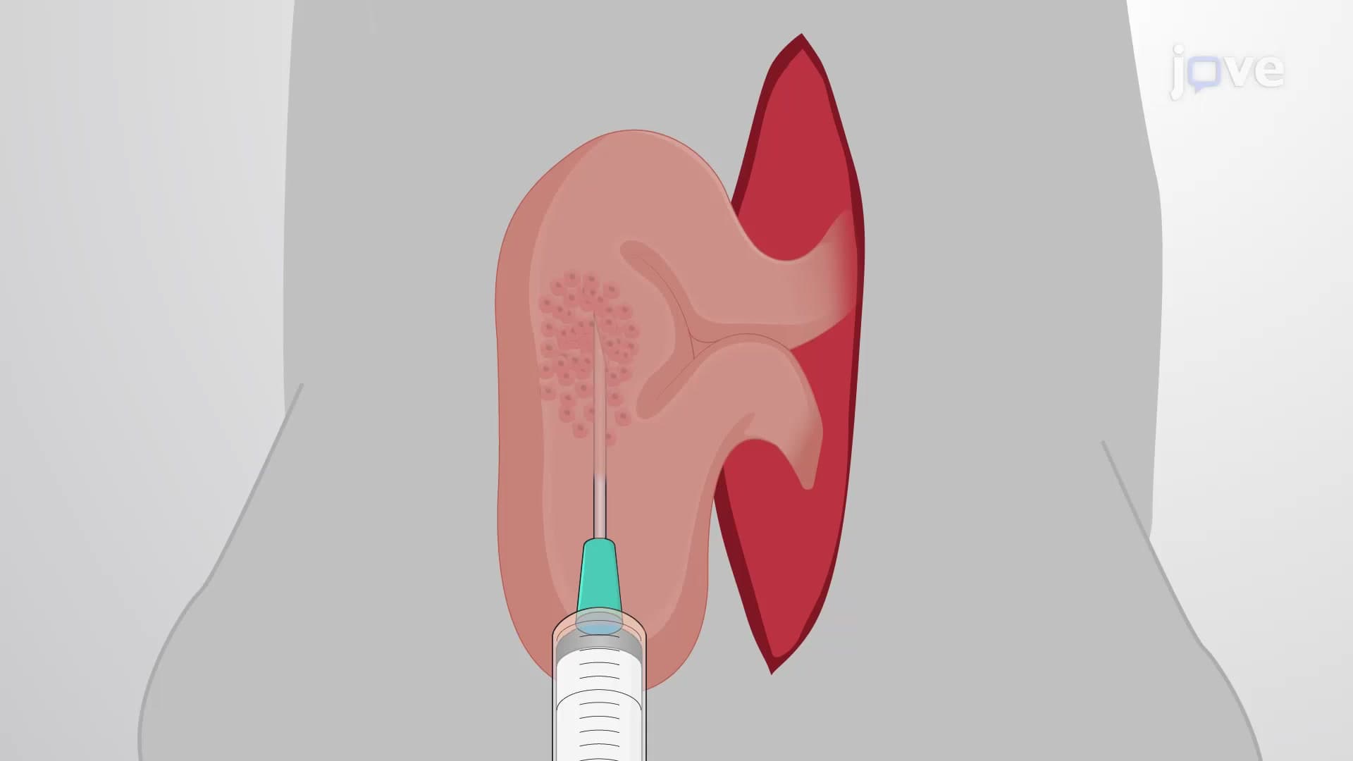 Intracecal Tumor Cell Injection: A Technique to Deliver Cancer Cells for Establishing Orthotopic Colorectal Cancer Mouse Model